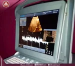 صورة طبيعية لشاشة سونار محمول ECO 1 للعيادات من شركة Chison، شاشة 12 بوصة، مجسات Convex وVaginal، بتصميم رمادي اللون.