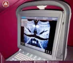 ⁦جهاز سونار شيزون ايكو 1⁩ - الصورة ⁦3⁩