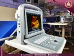 صورة طبيعية لسونار محمول ECO 1 للعيادات من شركة Chison، شاشة 12 بوصة، مجسات Convex وVaginal، بتصميم رمادي اللون.
