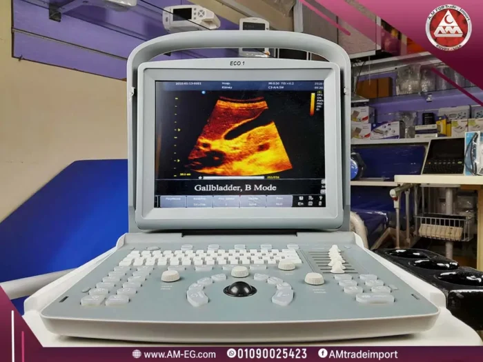 صورة طبيعية أمامية لسونار Chison ECO 1 المحمول، شاشة 12 بوصة، مجسات Convex وVaginal، بتصميم رمادي اللون ولوحة مفاتيح عالية الجودة.