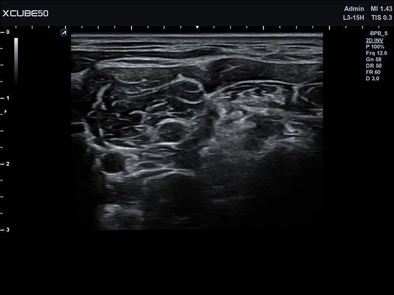 C-spine