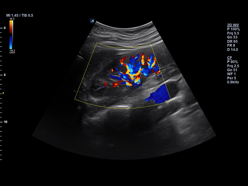 Kidney Color mode