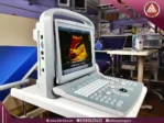 صورة طبيعية لسونار محمول ECO 1 للعيادات من شركة Chison، شاشة 12 بوصة، مجسات Convex وVaginal، بتصميم رمادي اللون.