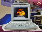 صورة طبيعية أمامية لسونار Chison ECO 1 المحمول، شاشة 12 بوصة، مجسات Convex وVaginal، بتصميم رمادي اللون ولوحة مفاتيح عالية الجودة.