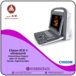 سونار محمول ECO 1 للعيادات من شركة Chison، شاشة 12 بوصة، مجسات Convex وVaginal، بتصميم عالي الجودة رمادي اللون.