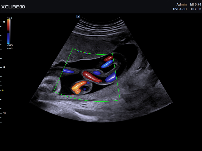 Fetus face with Depth View