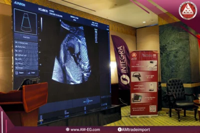 alpinion-ultrasound-am-eg-aicfm-2026-conference.webp (3)
