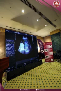 alpinion-ultrasound-am-eg-aicfm-2026-conference.webp (5)