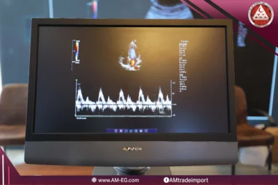 alpinion-ultrasound-monitor-cardiac-color-doppler-pw-spectrum