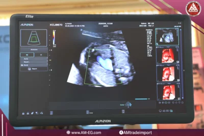 alpinion-x-cube-70-elite-ultrasound-monitor-fetal-echo-color-doppler-3d